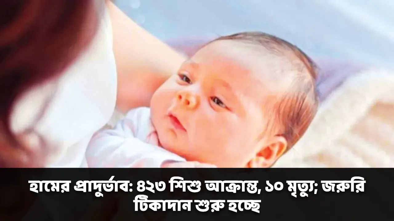 হামের প্রাদুর্ভাব: ৪২৩ শিশু আক্রান্ত, ১০ মৃত্যু; জরুরি টিকাদান শুরু হচ্ছে