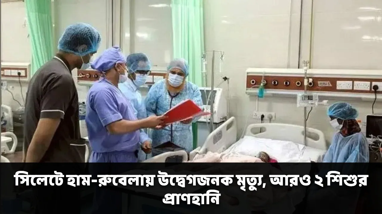 সিলেটে হাম-রুবেলায় উদ্বেগজনক মৃত্যু, আরও ২ শিশুর প্রাণহানি
